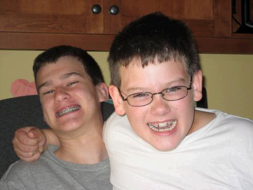 Clark and Elliot both had braces together for 5 days!